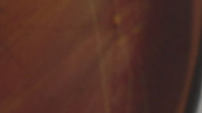 Brezilya'da Covid-19 vakalarında artış