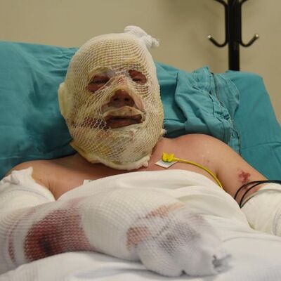 Ormancı Yaşar, yaşadığı dehşet anlarını anlattı