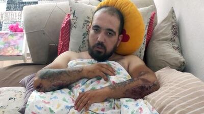 Ölümden dönen motosikletli kan donduran o anları anlattı