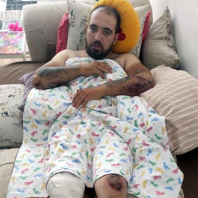 Ölümden dönen motosikletli kan donduran o anları anlattı