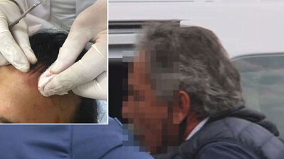 Çarptığı kapıyla doktoru yaraladı!