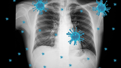 Bilim insanlarından dikkat çeken Covid açıklaması!