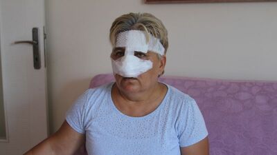 Antalya'da pitbull dehşeti! Burnunu kopardı