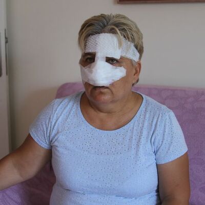 Antalya'da pitbull dehşeti! Burnunu kopardı