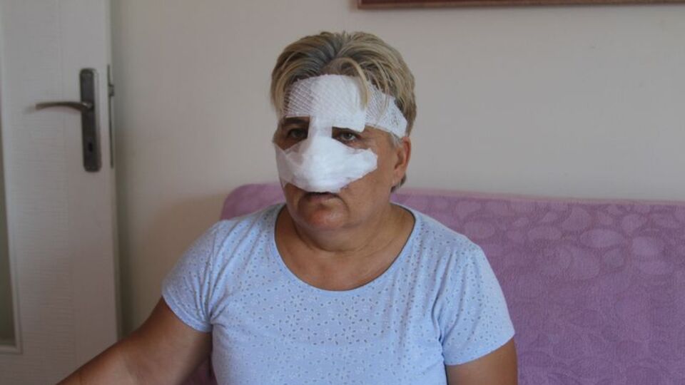 Antalya'da pitbull dehşeti! Burnunu kopardı