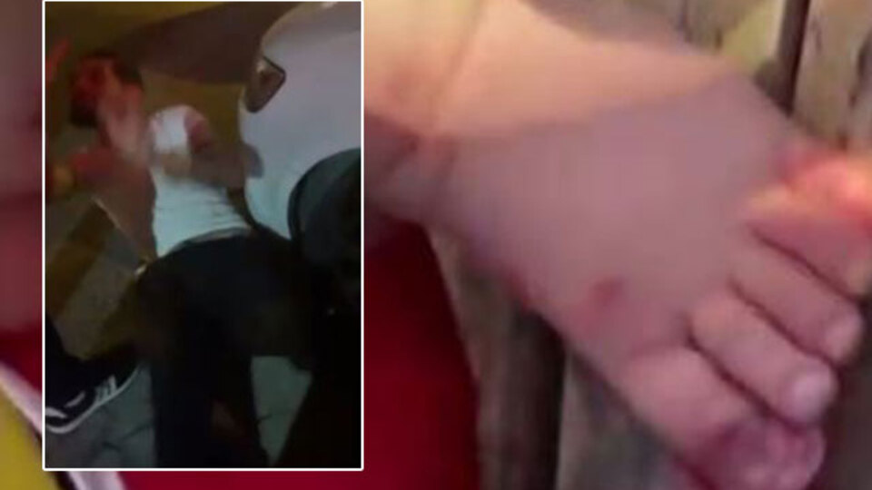 2 yaşındaki çocuğa işkence! Baba dehşeti!