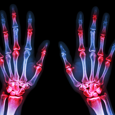 Korkunç! Sigara dumanına maruz kalan çocuklar gelecekte...