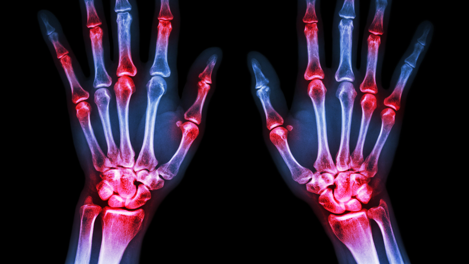 Korkunç! Sigara dumanına maruz kalan çocuklar gelecekte...