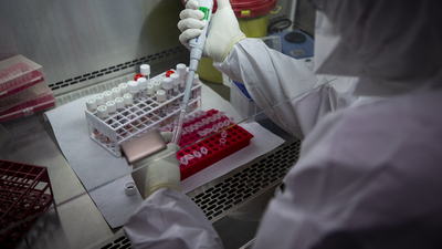 Covid'den nasıl etkileneceğinizi önceden bilmek ister misiniz!