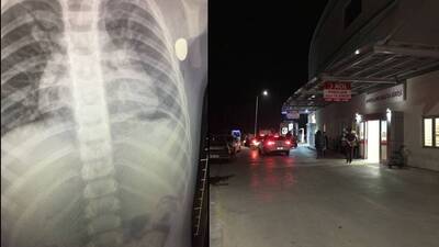 Minik Berk, maganda kurbanı!