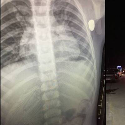 Minik Berk, maganda kurbanı!