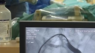 Araştırma ortaya koydu! Kan damarlarını erkenden yaşlandırıyor