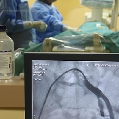 Araştırma ortaya koydu! Kan damarlarını erkenden yaşlandırıyor