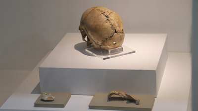 Ameliyattan sonra yaşamış... Canlandırılacak