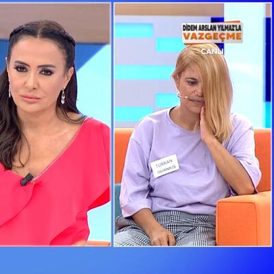 Eşinin yüzüne kezzap attı, 'Seviyorum' dedi