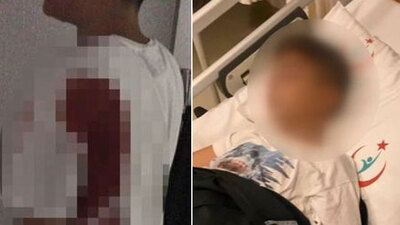 11 yaşında çocuk! Çivi sandı mermi çıktı!