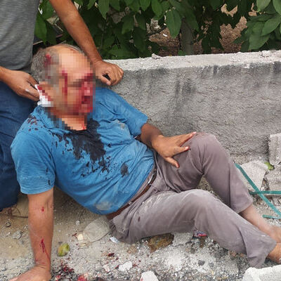 Herkesin başına gelebilir! Yolda yürüyordu!