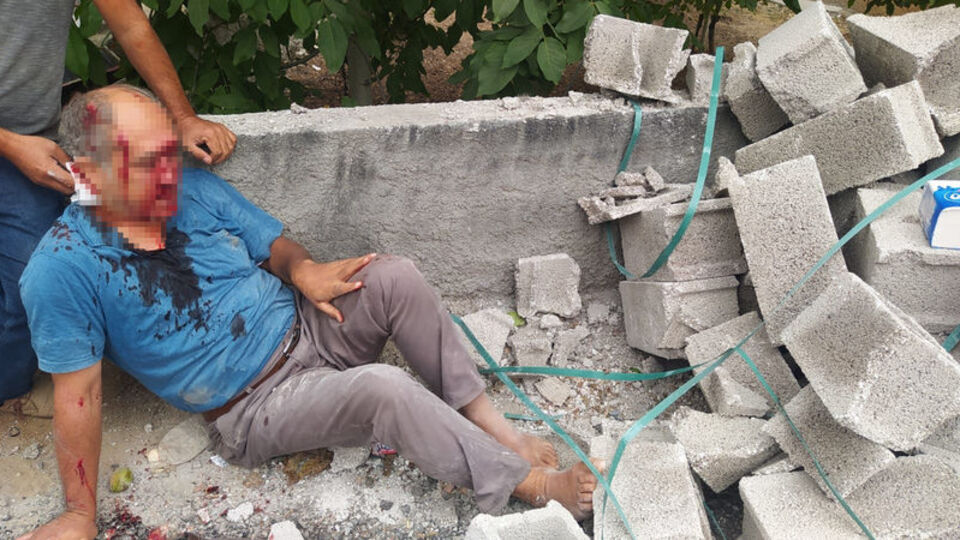 Herkesin başına gelebilir! Yolda yürüyordu!