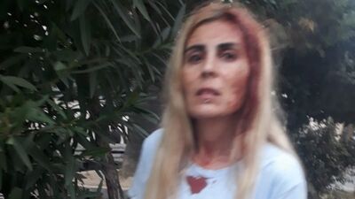 "Ölmek istemiyorum" dedi! Şikayetinden vazgeçmişti!