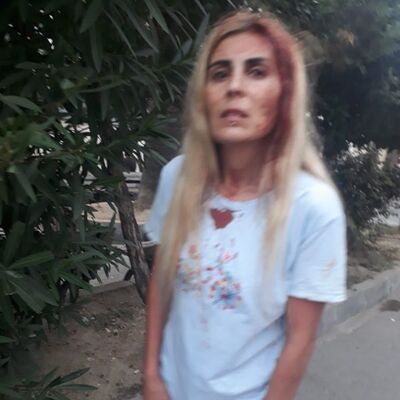 "Ölmek istemiyorum" dedi! Şikayetinden vazgeçmişti!