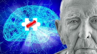 Yeni Alzheimer ilacı hastalığa çare mi?