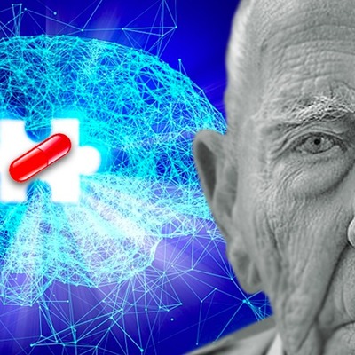 Yeni Alzheimer ilacı hastalığa çare mi?