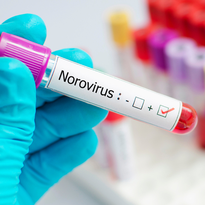 Bilim Kurulu Üyesi Prof. Dr. Yavuz'dan Norovirüs uyarısı!