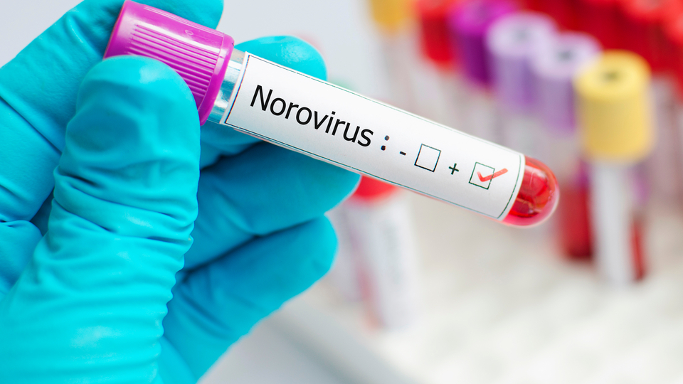 Bilim Kurulu Üyesi Prof. Dr. Yavuz'dan Norovirüs uyarısı!