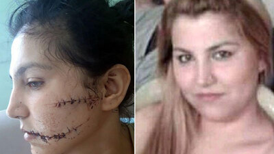 104 yerinden bıçaklandı! "Şah damarımı korudum"