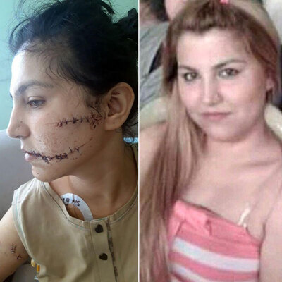 104 yerinden bıçaklandı! "Şah damarımı korudum"