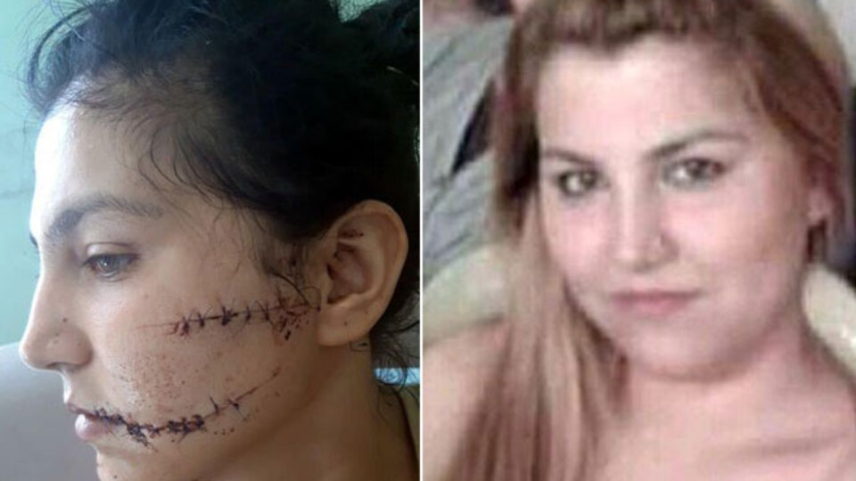 104 yerinden bıçaklandı! "Şah damarımı korudum"