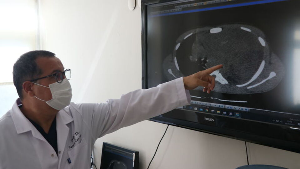 Karın boşluğunda 3 kiloluk kitle belirlendi