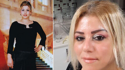 Her satırı korkunç! Öldüren estetik!