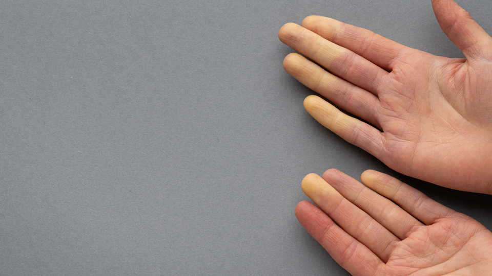 Bu belirtiyle ortaya çıkıyor! Tedavi edilmezse...