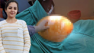 Tümörü alındı, 91 kilodan 70'e düştü