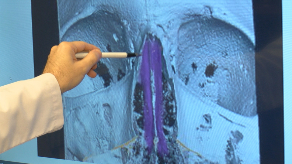 Türk doktorlar araştırdı! 'Tazı burun' olarak nitelenen kişilerde...