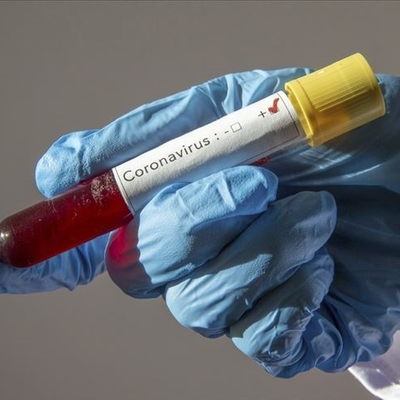 İlk kez atık suda canlı virüs tespit edildi!