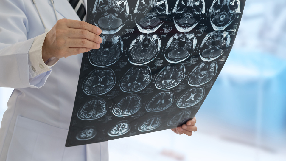 Korkutan açıklama! 'Covid-19 geçirenlerin beyninde küçülme'