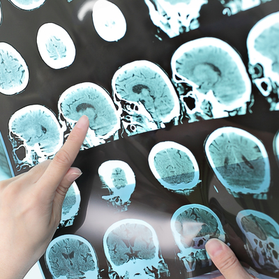 Gelip geçici şikayetlere dikkat! Gözlerde bulanıklık, kolda bacakta uyuşukluk varsa...