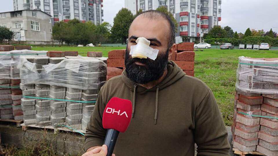 Pitbull, iş insanına dehşeti yaşattı