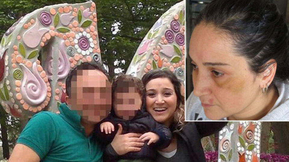 Kocası darp etti! Aracını yaktı! "Ne olur duy sesimi!"