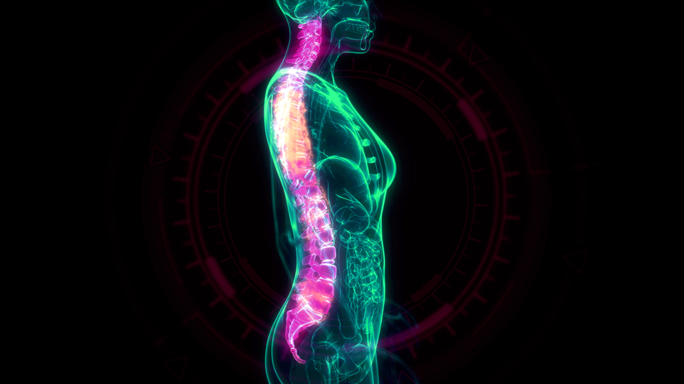 Osteoporoz ortaya çıkmadan önlemek mümkün!