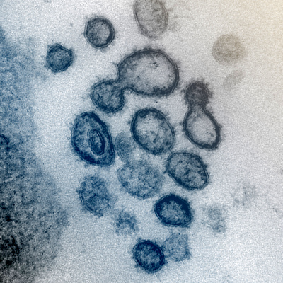 Covid-19'un kaynağına ilişkin çarpıcı iddia!