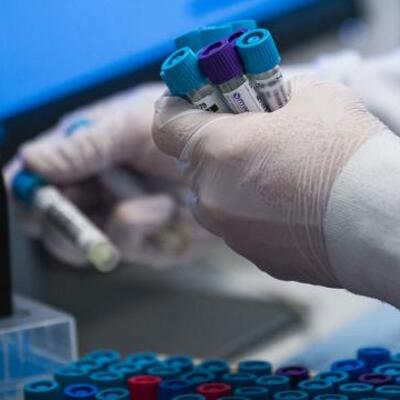 İstanbul'da PCR testi sahtekarlığı