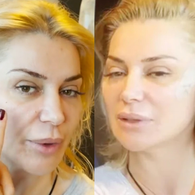 İşte yeni Songül! Estetik operasyon geçirdi...