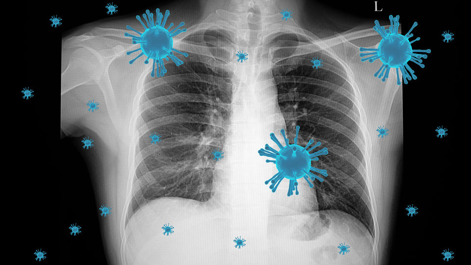 Covid-19 biyolojik silah olarak mı geliştirildi?