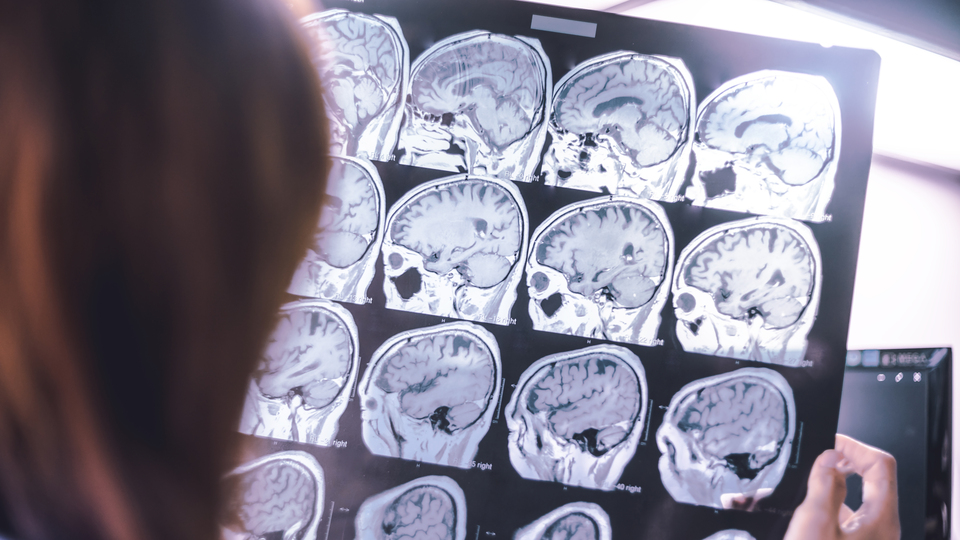 Pandemide inme belirtilerine rağmen hastalar doktora gitmedi