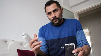 Şarj cihazı patladı! Parmağı koptu!