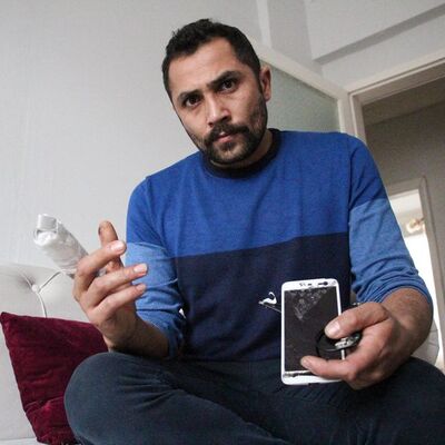 Şarj cihazı patladı! Parmağı koptu!