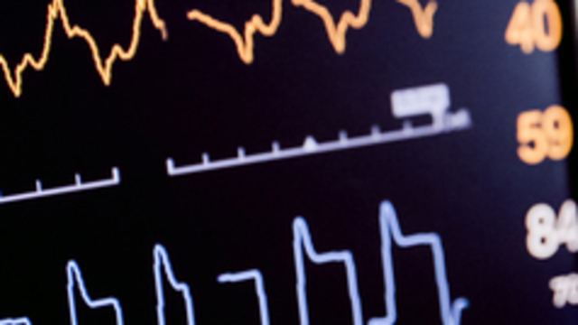 Kalp pili ve EKG üretimi risk altında
